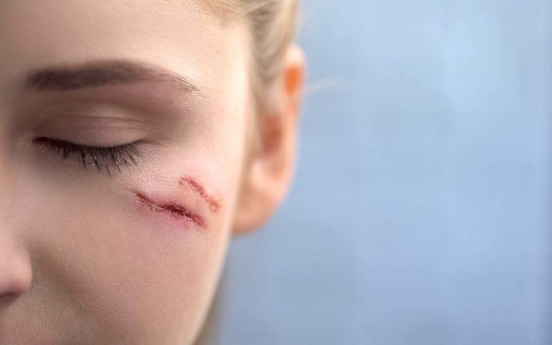 Scars Tell a Story